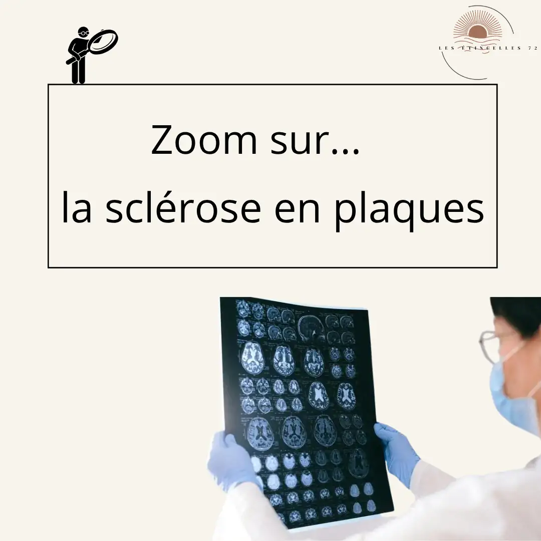 🧠 Zoom sur la Sclérose en Plaques