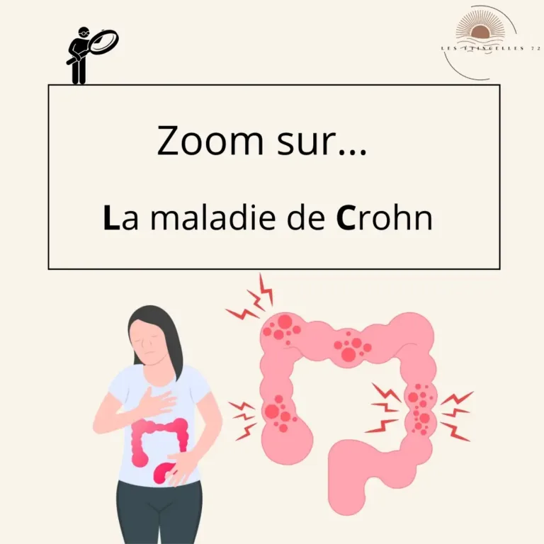 Zoom sur la maladie de Crohn